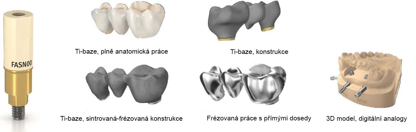 Obrázek protetické práce CAD systémy