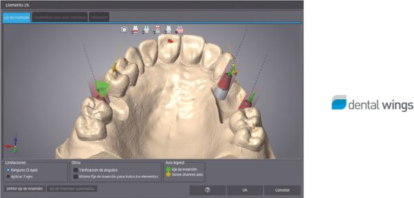 http://www.proteticke-komponenty.cz/images/dental_wings_cad_cam_knihovny.jpg