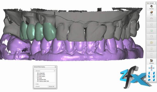 http://www.proteticke-komponenty.cz/images/multiunit_abutmenty_proteticke_prace_ia.jpg