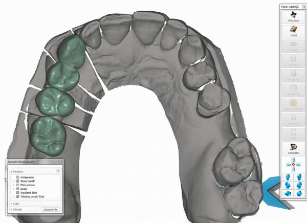http://www.proteticke-komponenty.cz/images/multiunit_abutmenty_proteticke_prace_ii.jpg