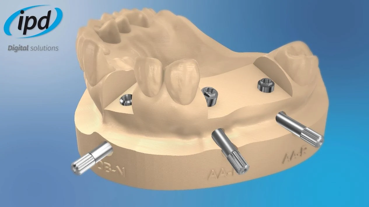 3D tištěný model s digitálními analogy IPD