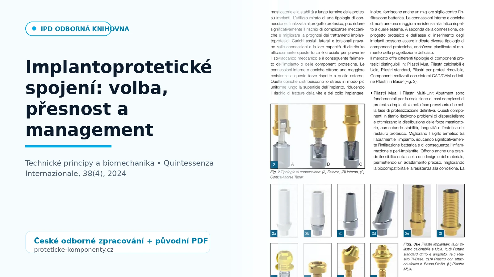 Implant-prosthetic connection: selection, accuracy and management