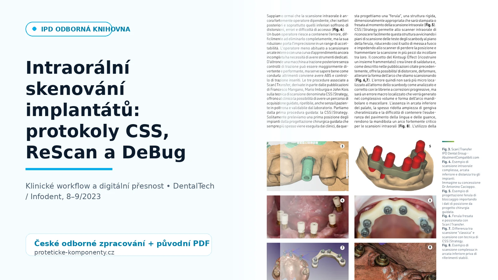 Intraoral implant scanning: CSS, ReScan and DeBug protocols