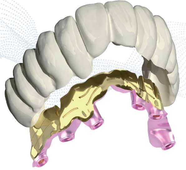 iDent bridge – služby a digitální workflow