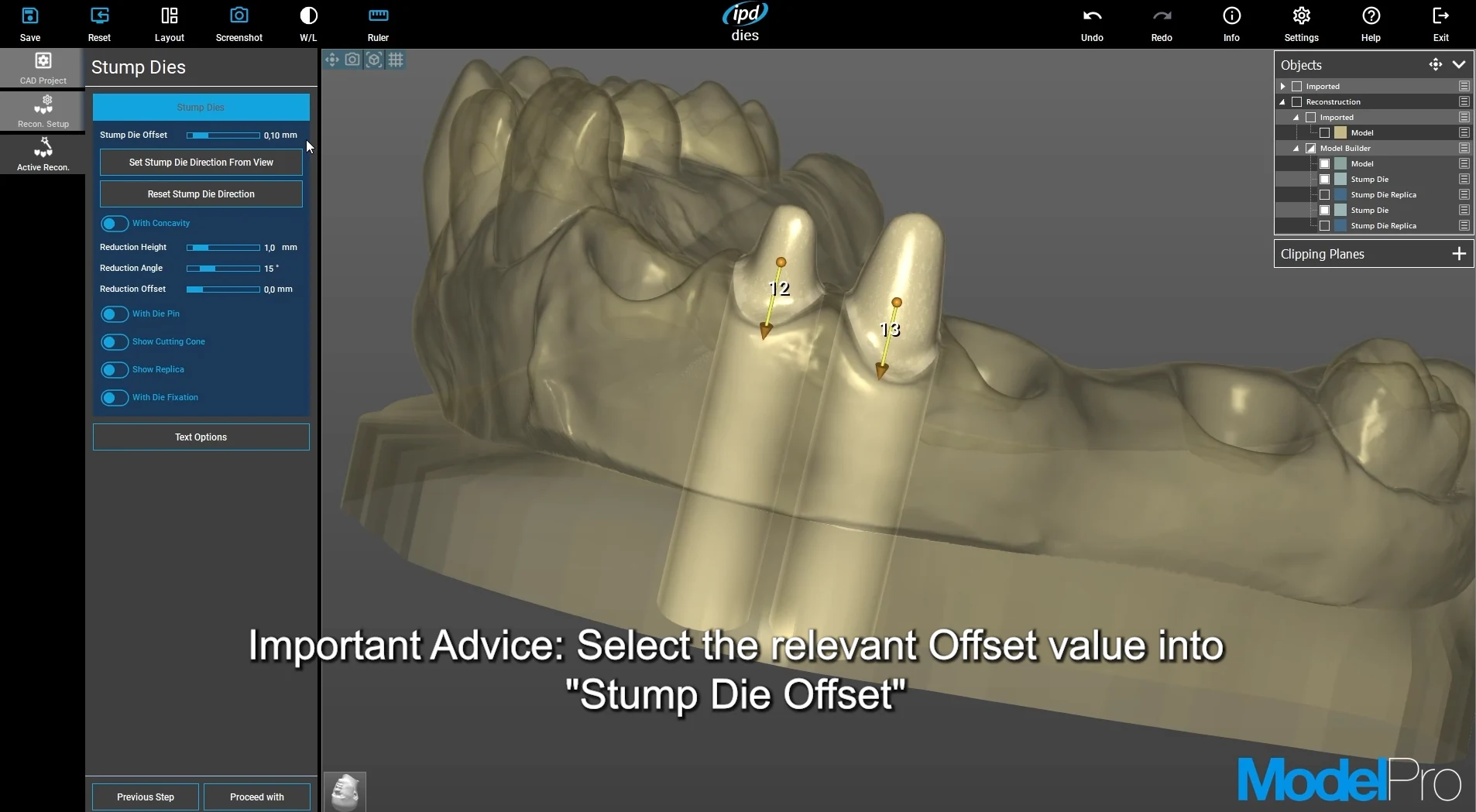 Náhled instruktážního videa: ModelPro: vyjímatelný pahýl ve 3D modelu