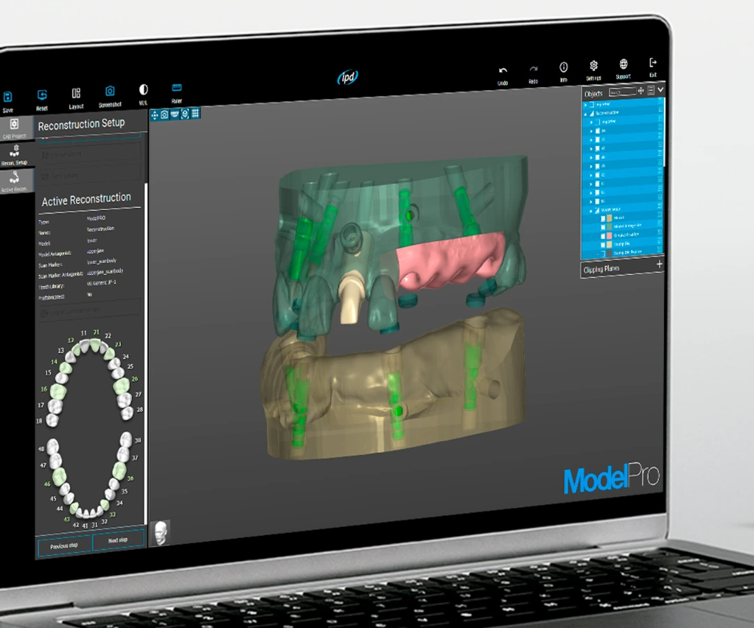 ModelPro CAD software pro 3D tištěné dentální modely
