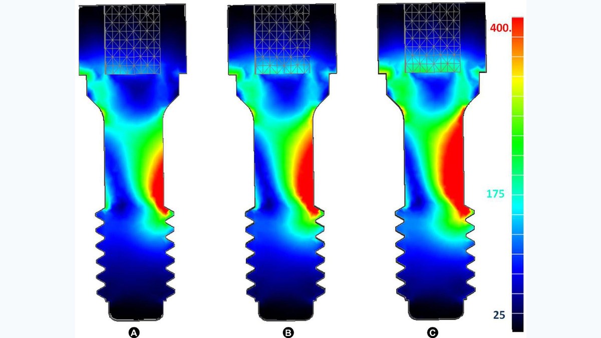 Stress map of a screw joint from the original tightening article
