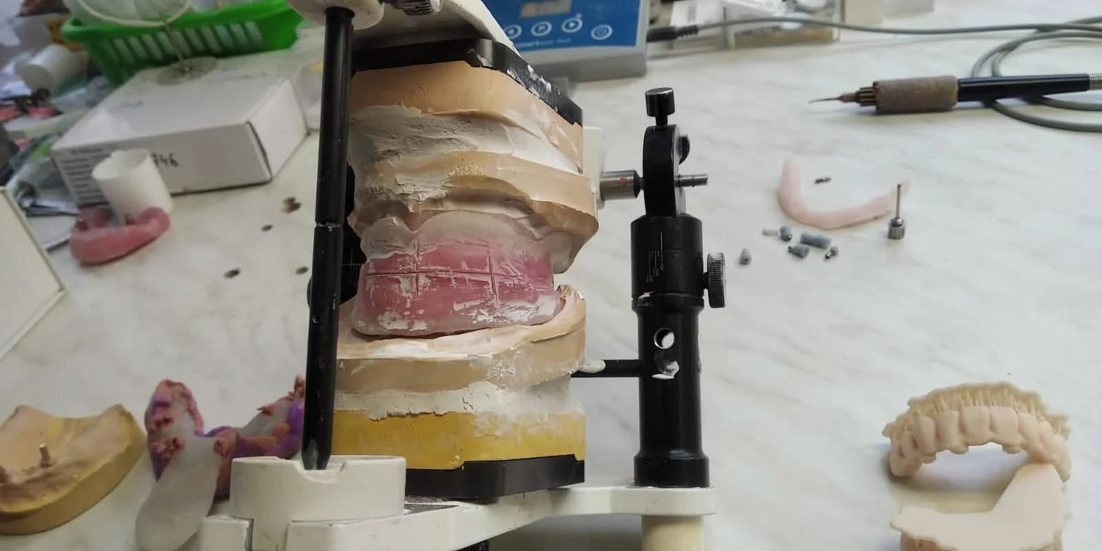 Scan Transfer clinical case, step four