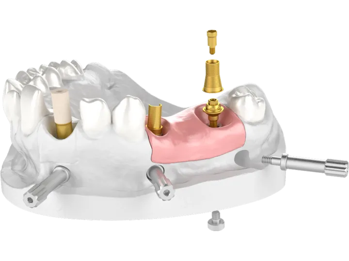 CAD CAM Komponenty na zubní implantáty